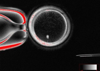 Shkencëtarët krijojnë vezë njerëzore nga qelizat e lëkurës: një epokë e re për trajtimin e infertilitetit