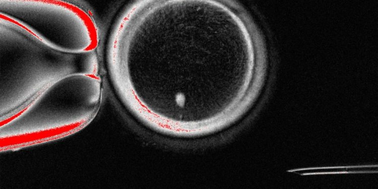 Shkencëtarët krijojnë vezë njerëzore nga qelizat e lëkurës: një epokë e re për trajtimin e infertilitetit