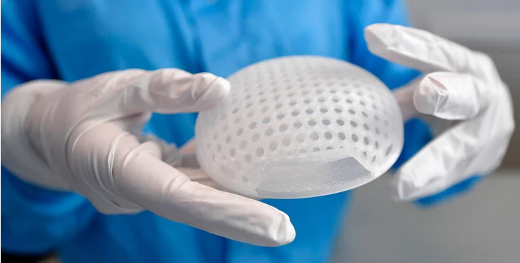 Inde që mund të rikthejnë shpresën: Inxhinierja që synon të rindërtojë gjirin me teknologji 3D për të mbijetuarat e kancerit