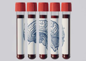 A mund ta parashikojë një analizë gjaku Alzheimerin? Shkencëtarët japin përgjigjen
