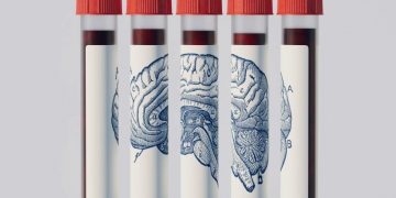 A mund ta parashikojë një analizë gjaku Alzheimerin? Shkencëtarët japin përgjigjen