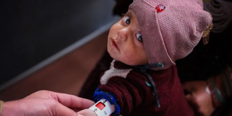 3.7 milionë fëmijë në Afganistan vuajnë nga kequshqyerja akute, UNICEF jep alarmin